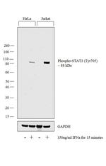 Phospho-STAT3 (Tyr705) Antibody in Western Blot (WB)