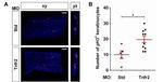 RFP Antibody in Immunohistochemistry (IHC)