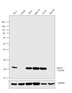 GSTP1 Antibody in Western Blot (WB)