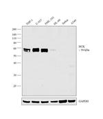 HCK Antibody in Western Blot (WB)