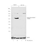 Human Serum Albumin Antibody in Western Blot (WB)