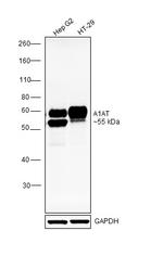 alpha-1 Antitrypsin Antibody in Western Blot (WB)