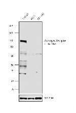 Androgen Receptor Antibody