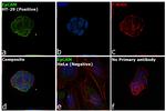 EpCAM Antibody