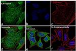 STAT6 Antibody