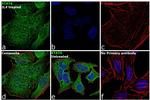 STAT6 Antibody in Immunocytochemistry (ICC/IF)