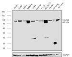 STAT5 beta Antibody in Western Blot (WB)