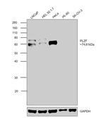 PLZF Antibody