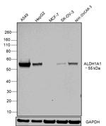 ALDH1A1 Antibody in Western Blot (WB)