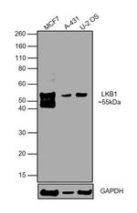 LKB1 Antibody in Western Blot (WB)