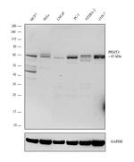 PRMT4 Antibody in Western Blot (WB)