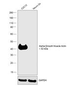 Alpha-Smooth Muscle Actin Antibody