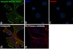 Alpha-Smooth Muscle Actin Antibody in Immunocytochemistry (ICC/IF)