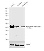 Alpha-Smooth Muscle Actin Antibody in Western Blot (WB)