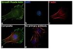 Alpha-Smooth Muscle Actin Antibody in Immunocytochemistry (ICC/IF)