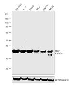 SMN1 Antibody in Western Blot (WB)