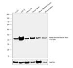 Alpha-Smooth Muscle Actin Antibody in Western Blot (WB)