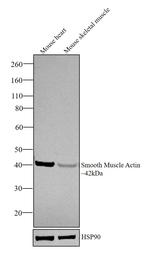 Alpha-Smooth Muscle Actin Antibody in Western Blot (WB)