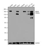 MSH6 Antibody in Western Blot (WB)