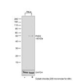 PHD2 Antibody in Western Blot (WB)