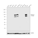 DNMT3A Antibody in Western Blot (WB)