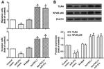 NFkB p65 Antibody in Western Blot (WB)