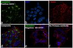 Caveolin 1 Antibody in Immunocytochemistry (ICC/IF)