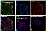 Cytokeratin 5 Antibody