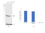 Stathmin 1 Antibody in Western Blot (WB)