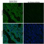 Vimentin Antibody in Immunohistochemistry (Paraffin) (IHC (P))