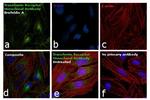 Transferrin Receptor Antibody in Immunocytochemistry (ICC/IF)