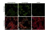 Huntingtin Antibody in Immunocytochemistry (ICC/IF)