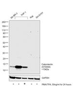 Calprotectin Antibody