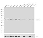 KPNA2 Antibody in Western Blot (WB)