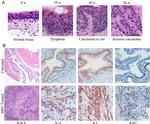 Ki-67 Antibody in Immunohistochemistry (Paraffin) (IHC (P))