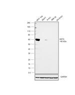 Cytokeratin 5 Antibody in Western Blot (WB)