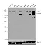 MSH6 Antibody in Western Blot (WB)