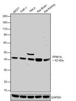 PPM1A Antibody in Western Blot (WB)