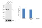 RPA70 Antibody in Western Blot (WB)