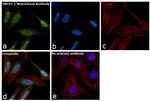 TWIST1 Antibody in Immunocytochemistry (ICC/IF)