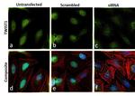 TWIST1 Antibody in Immunocytochemistry (ICC/IF)