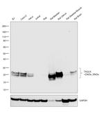 TAGLN Antibody in Western Blot (WB)