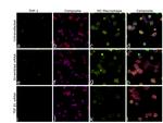 TGF beta-1 Antibody