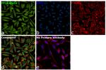 PP2A alpha Antibody in Immunocytochemistry (ICC/IF)