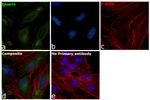 Emerin Antibody in Immunocytochemistry (ICC/IF)