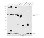 Dopamine Transporter Antibody in Western Blot (WB)