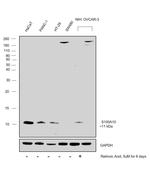 S100A10 Antibody in Western Blot (WB)