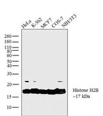 Histone H2B Antibody in Western Blot (WB)