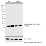 H2BK20ac Antibody in Western Blot (WB)