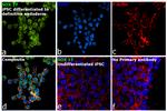 SOX17 Antibody in Immunocytochemistry (ICC/IF)